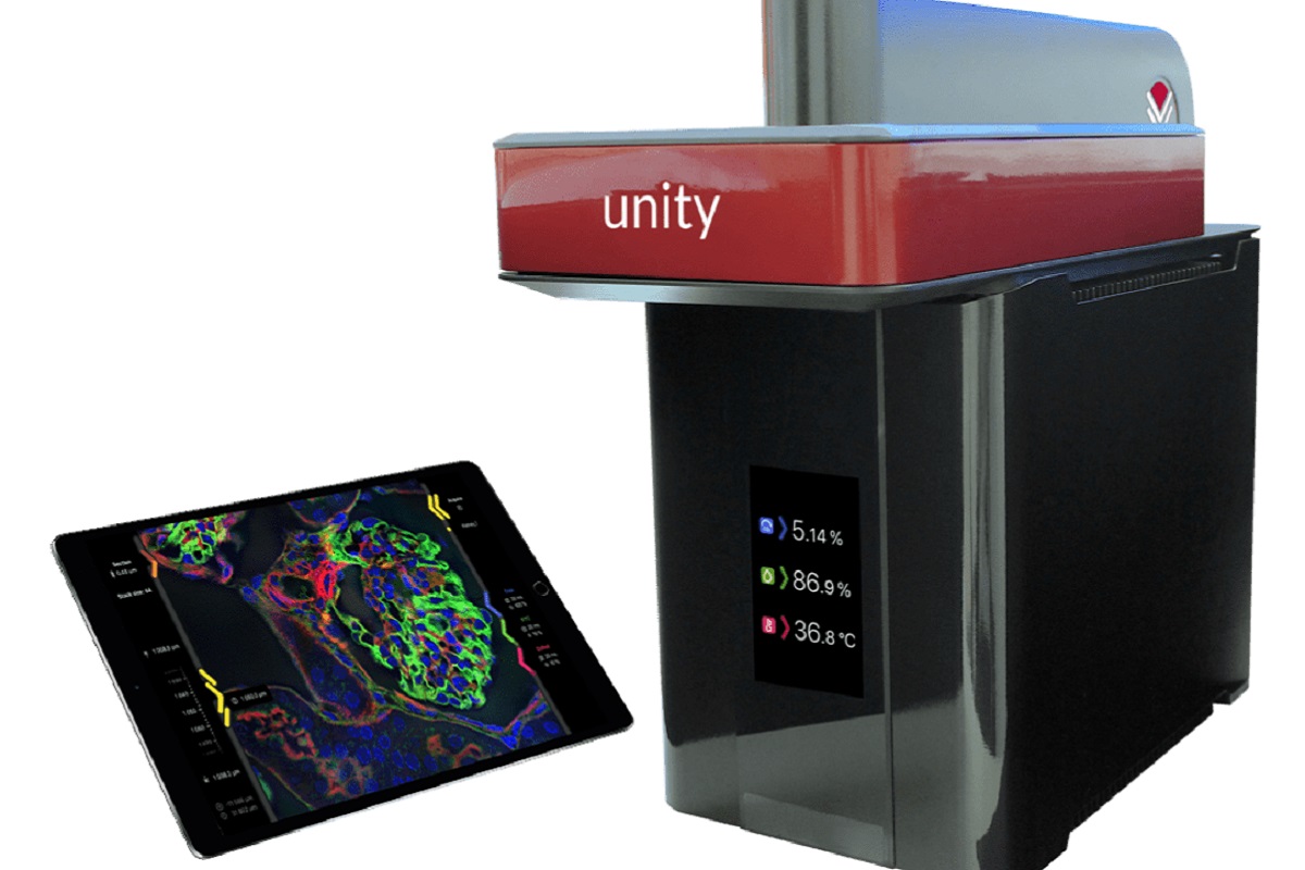 Unity - The All-In-One Benchtop SD Confocal