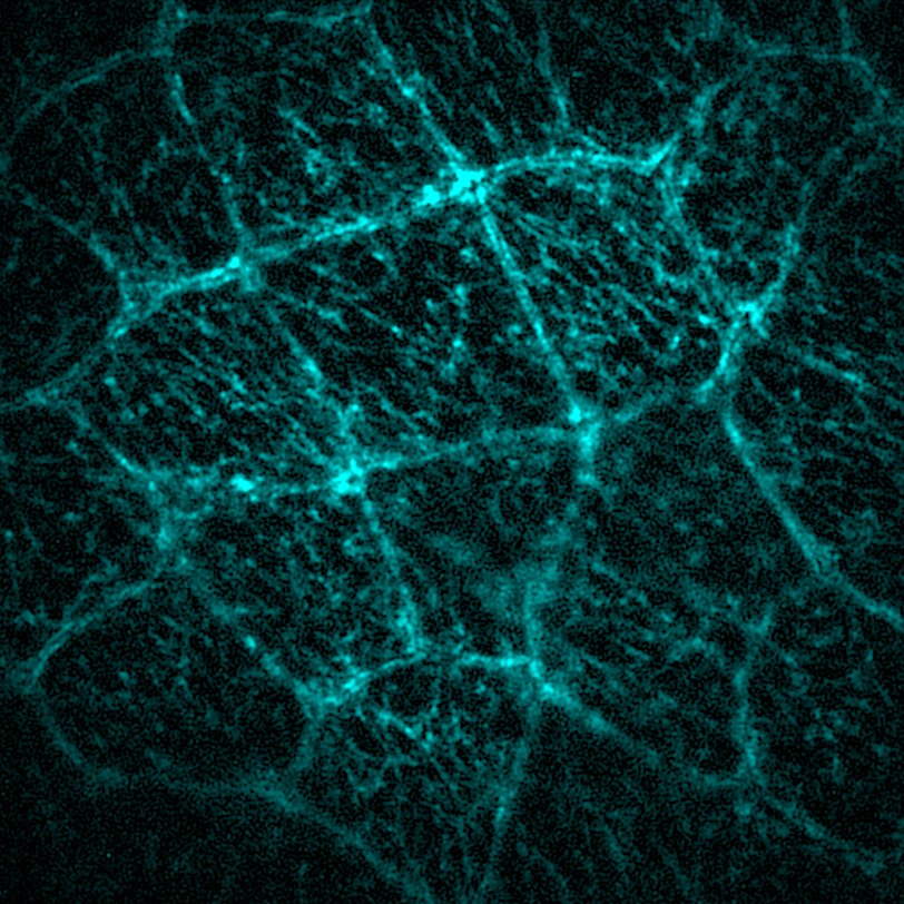 liveDRIM 如何做到 100 µm 成像深度与高鲁棒性